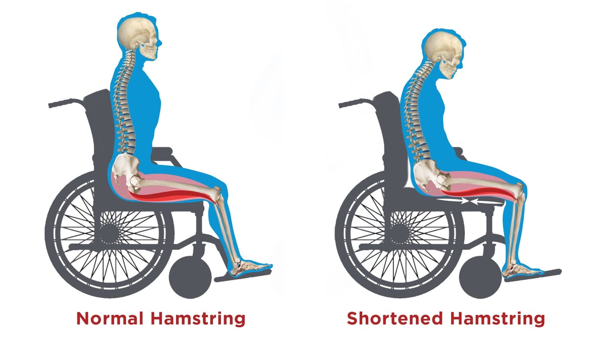 Wheelchair Seating & Positioning Guide